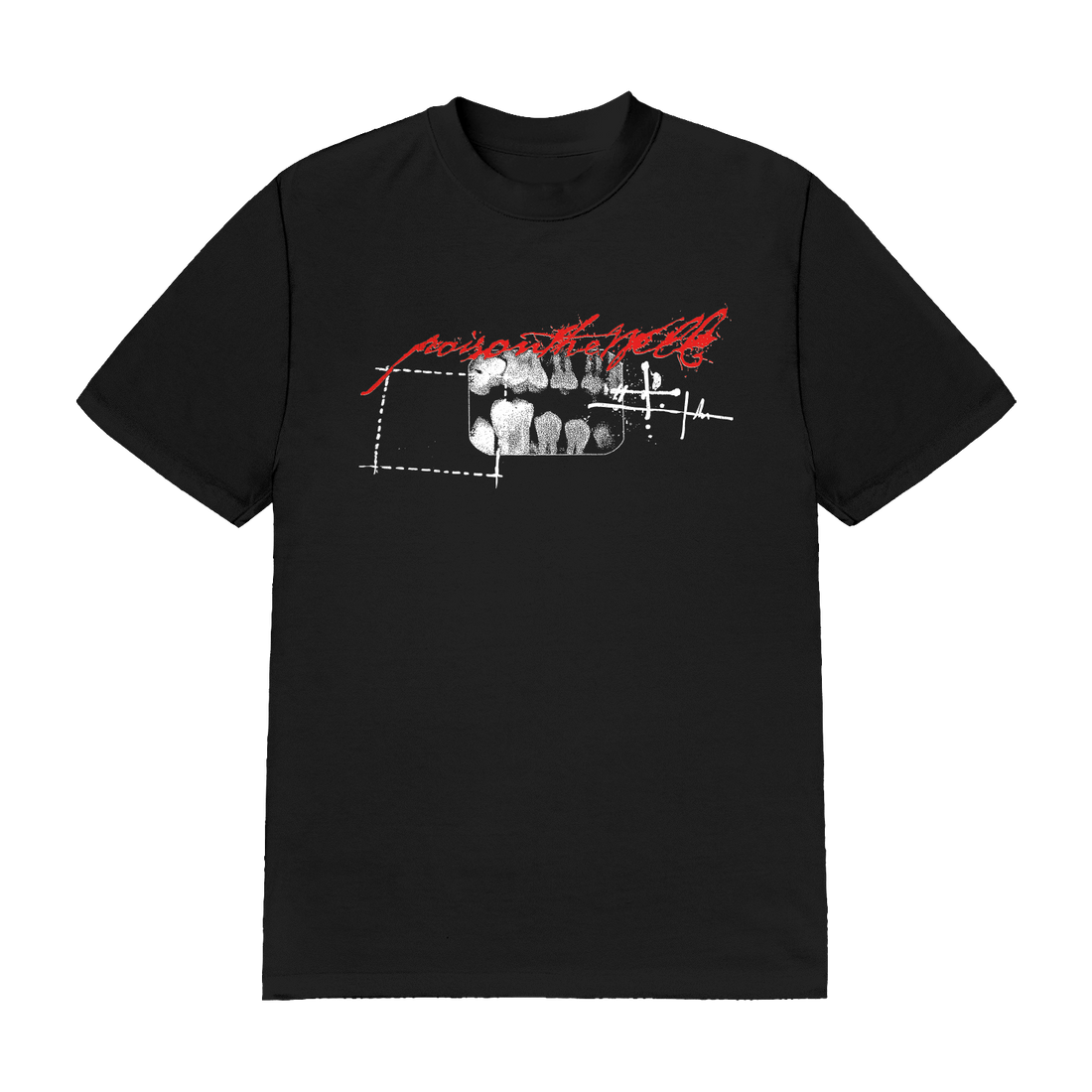 X-Ray Tee