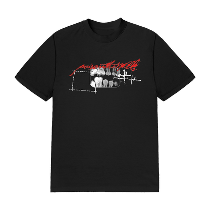 X-Ray Tee